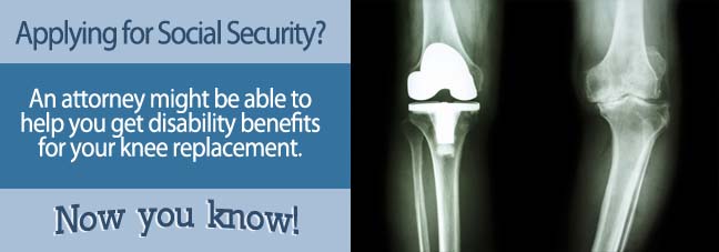 How To Apply for Benefits for a Knee Replacement